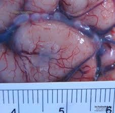 Баротравма легких 