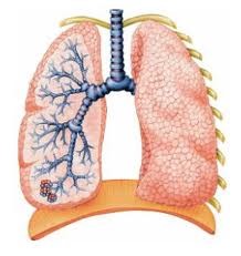 Бронхит хронический 