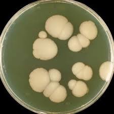 Кандидоз легких 