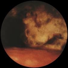 Болезни плевры 