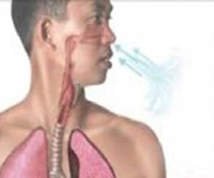 Гемоптизис. Причины и диагностика