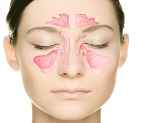 Эффективные методы лечения гайморита
