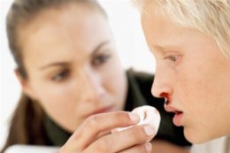 Носовое кровотечение: лечение доступными способами.